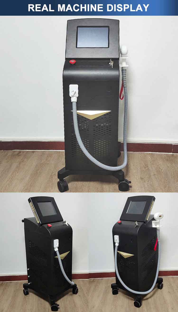 808nm laser diode hair removal device
